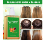 Champú De Aceite De Batana, Crecimiento Y Rejuvenecimiento,